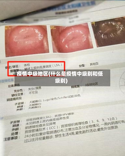 疫情中级地区(什么是疫情中级别和低级别)-第3张图片