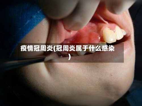疫情冠周炎(冠周炎属于什么感染)-第2张图片